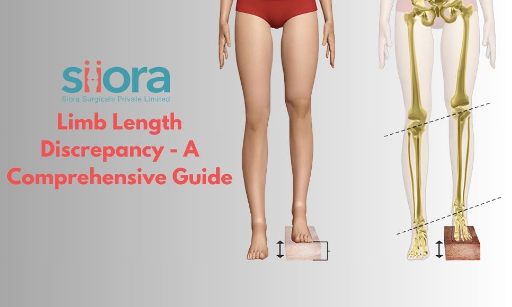 Limb Length Discrepancy – A Comprehensive&nbsp;Guide